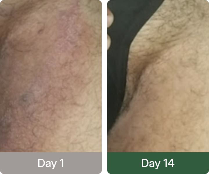 Before and after result 5